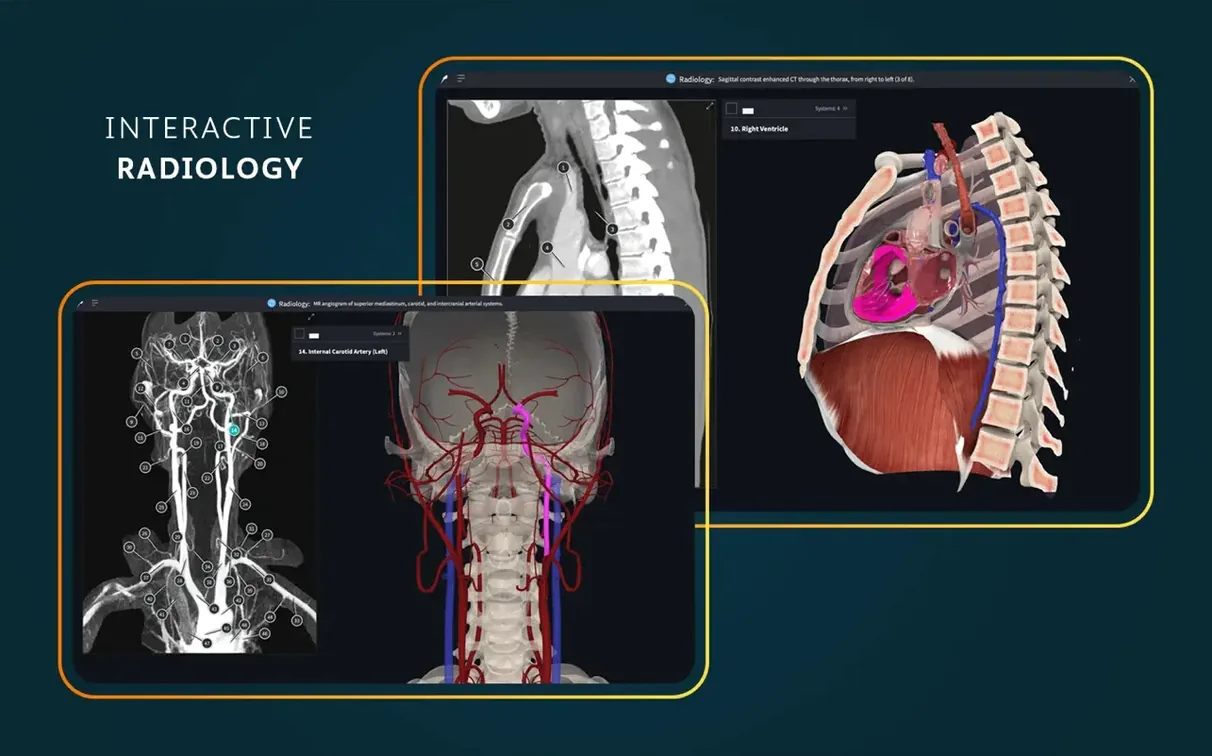 Screen 7 from Complete Anatomy Complete Anatomy window 7
